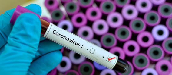Emergenza Coronavirus: online il nuovo modello di autocertificazione in caso di spostamenti